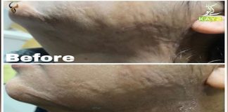 Awareness of Skin Problems | Chehray with Dr. Kashif | Ep # 01 | 7th December 2020 | K2 | Kay2 TV Awareness of Skin Problems | Chehray with Dr. Kashif | Ep # 01 | 7th December 2020 | K2 | Kay2 TV