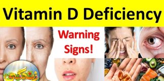 Symptoms of Vitamin D Deficiency | Zindagi | 27th September 2023 | Kay2 TV