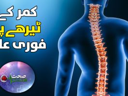 Scoliosis Symptoms, Diagnosis and Treatment | Sehat Aur Tandrusti | 14th November 2023 | Kay2 TV