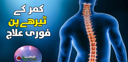 Scoliosis Symptoms, Diagnosis and Treatment | Sehat Aur Tandrusti | 14th November 2023 | Kay2 TV