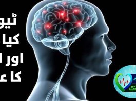 Types Of Tumors in Human Body | Jan Ha Tu Jhan Hay | 20th January 2024 | Kay2TV