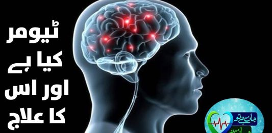 Types Of Tumors in Human Body | Jan Ha Tu Jhan Hay | 20th January 2024 | Kay2TV